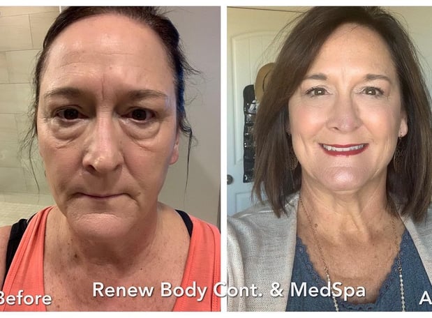 Images Renew Body Contouring & MedSpa