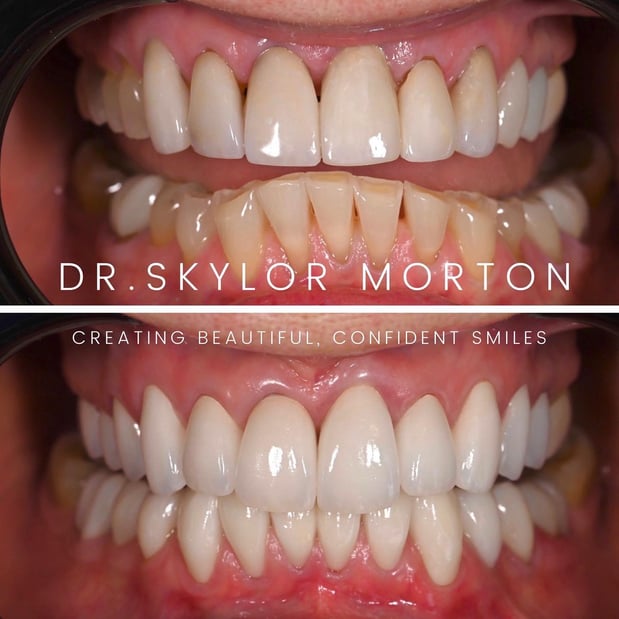 Images Nashville Wisdom Teeth and Implant Solutions