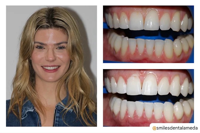 Images Clínica SmilesDent Alameda