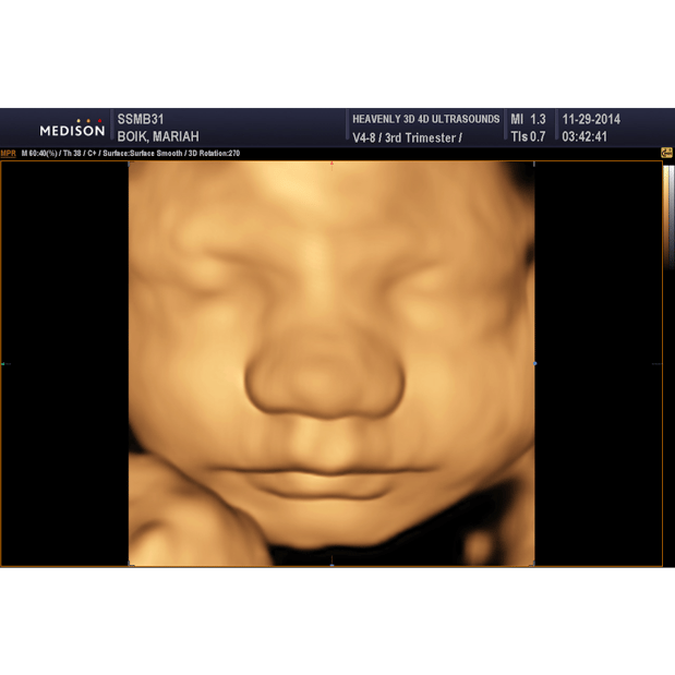 Images Heavenly 3D 4D Ultrasounds