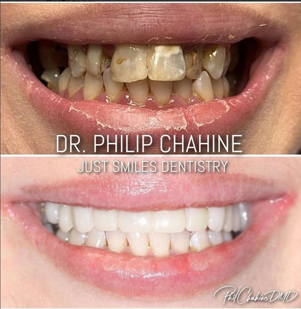 Images Just Smiles - General, Cosmetic & Implant Dentistry