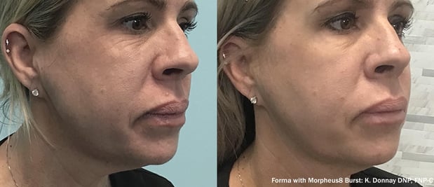 Images EliteBio: Hormone and Aesthetic Solutions