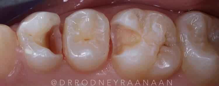 Images Dr. Rodney Raanan