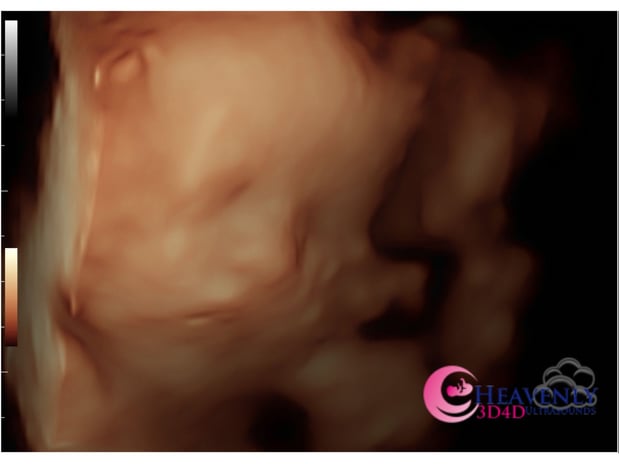 Images Heavenly 3D 4D Ultrasounds