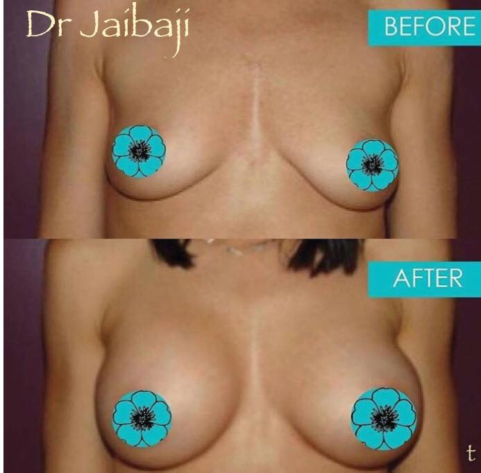 Jaibaji Plastic Surgery Photo