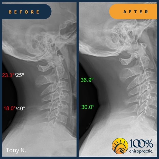 Images 100% Chiropractic - Lake Charles