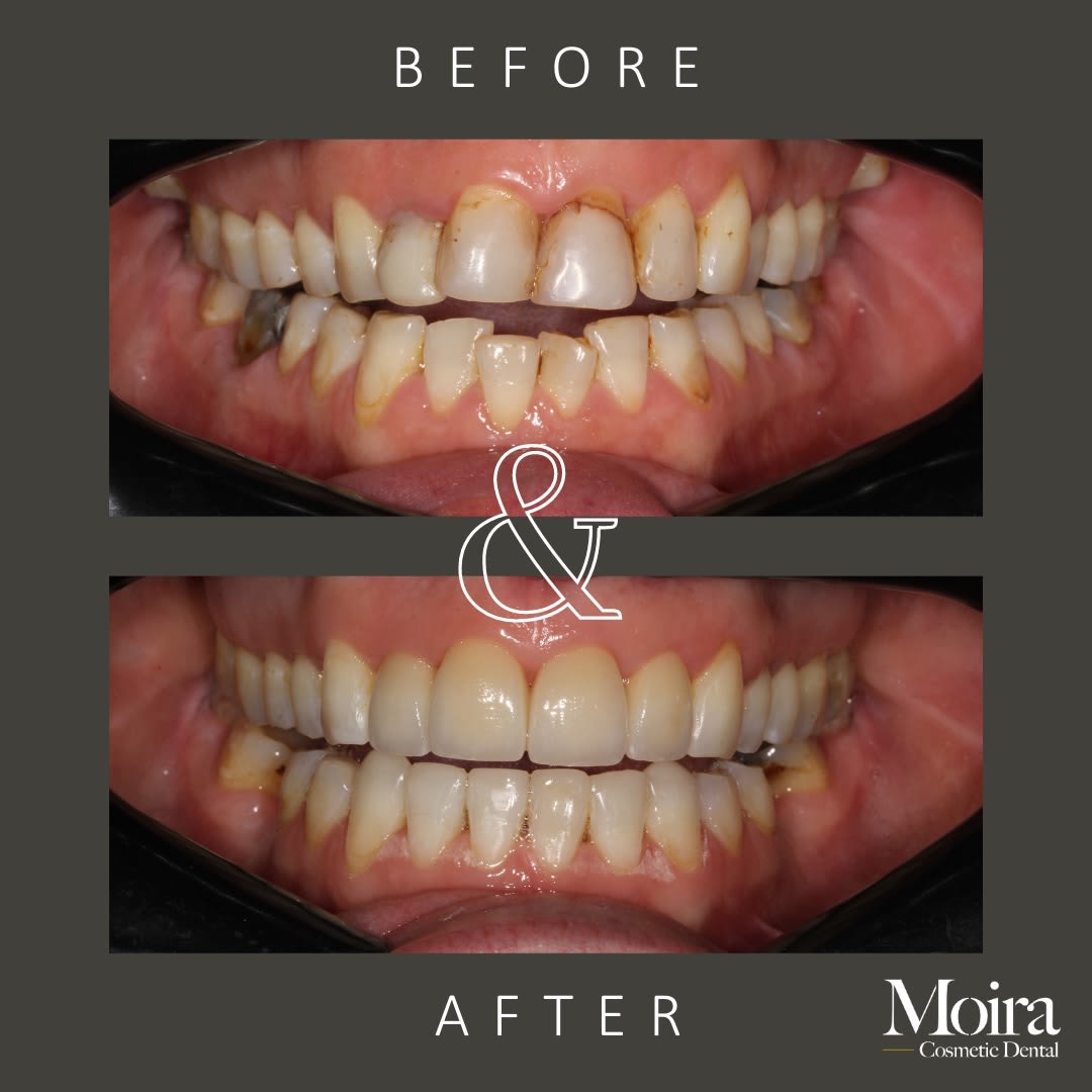 Images Moira Cosmetic Dental