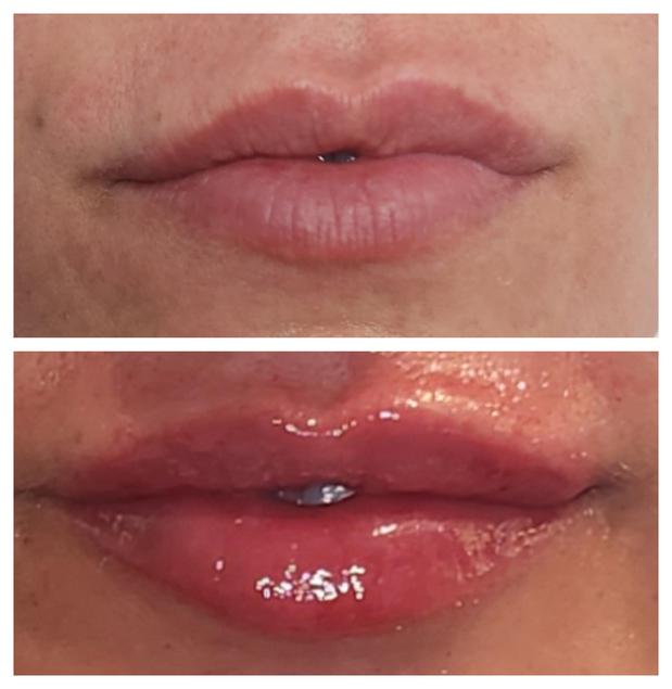 Images Monaco MedSpa
