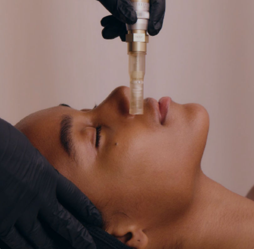 New Woodhouse Facial: Nano Channeling by HydraFacial