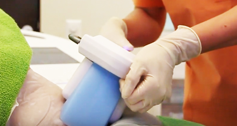 ICE AESTHETIC - Zentrum Kryolipolyse Mannheim - Prof. Dr. Proebstle, P6,26 / Auf den Planken in Mannheim