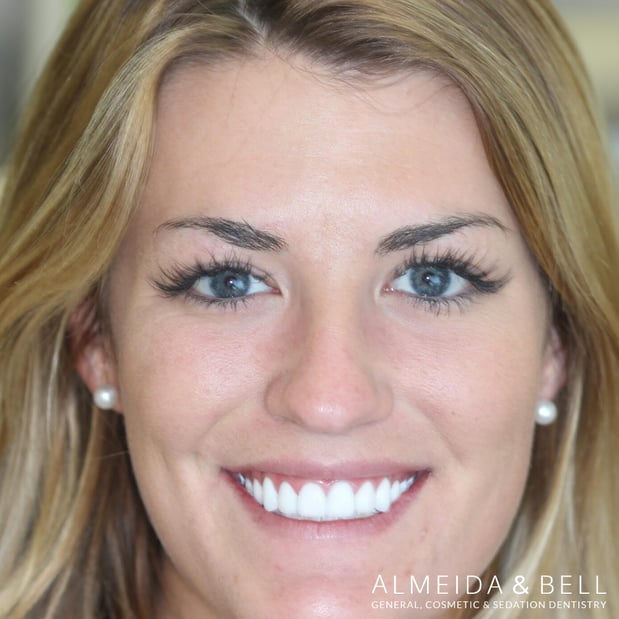 Images Almeida & Bell Dental Lone Tree - General, Cosmetic, and Implant Dentistry
