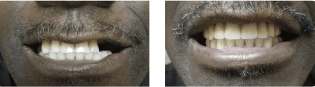 Images Allen Dentistry