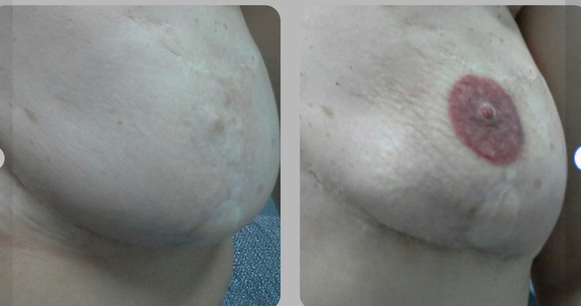 Images Raquel Velasco Micropigmentación