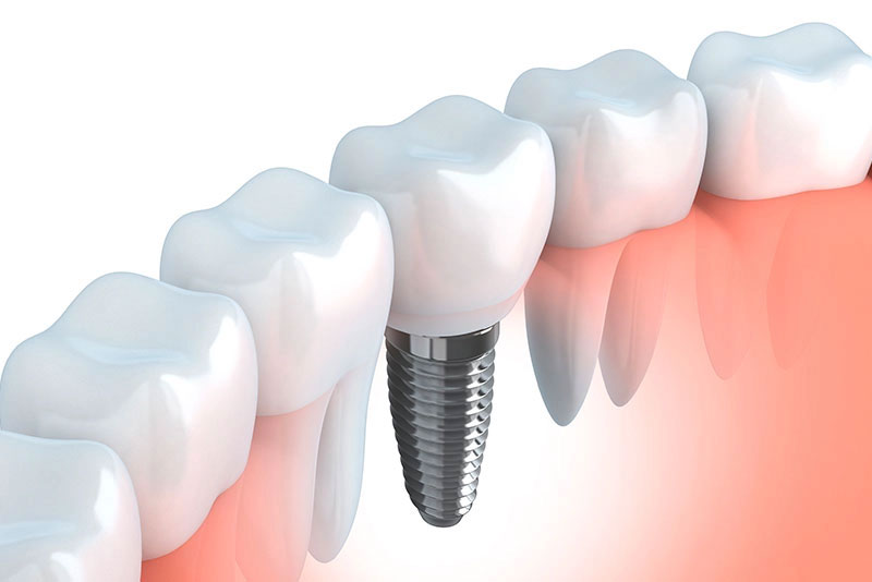 Images 32 Cliniche Dentali