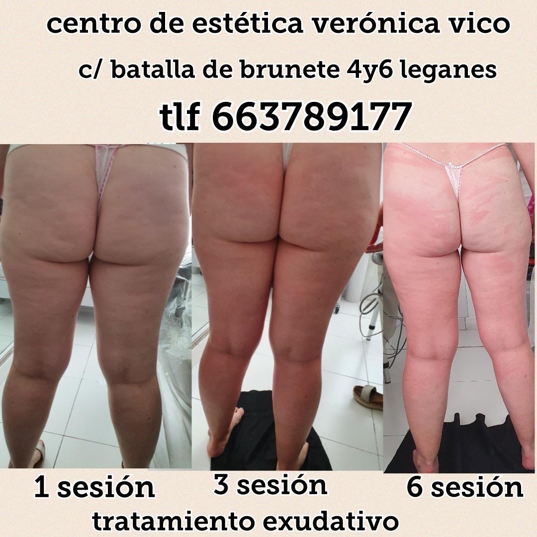 Images Centro De Estética Avanzada Y Láser Verónica Vico