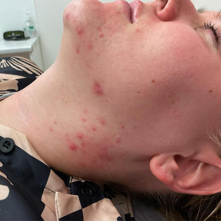 Images DERMA GLOW SOUTH YARRA ( Formerly Known as ALS)