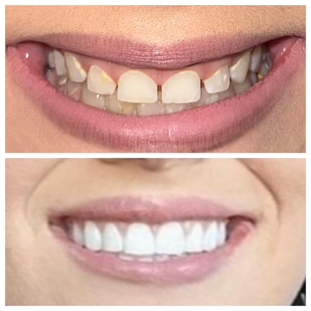 Images Summerlin Dental Solutions