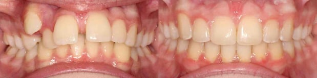 Images Speaker Orthodontics