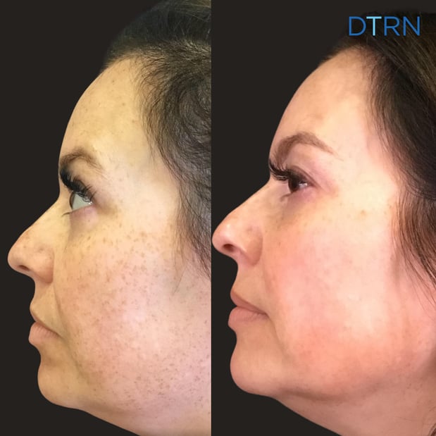 Images DermaTouch RN