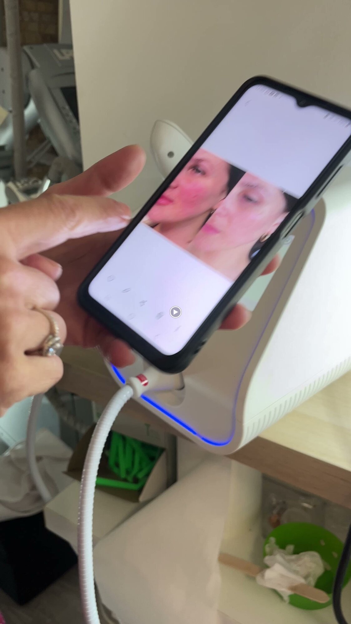 Images Diodolaser Madrid