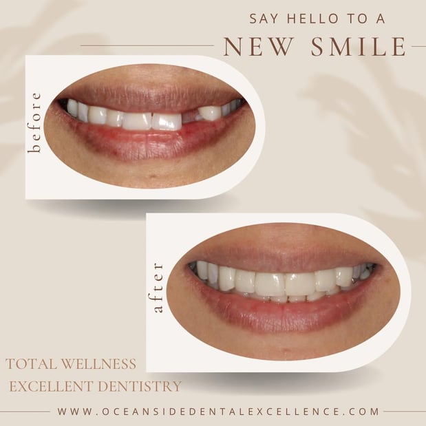Images Oceanside Dental Excellence