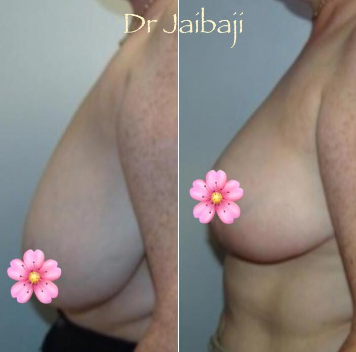 Jaibaji Plastic Surgery Photo