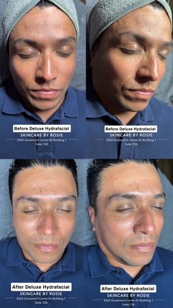 Images Skincare by Rosie