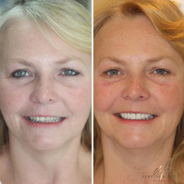 Images Almeida & Bell Dental Lone Tree - General, Cosmetic, and Implant Dentistry