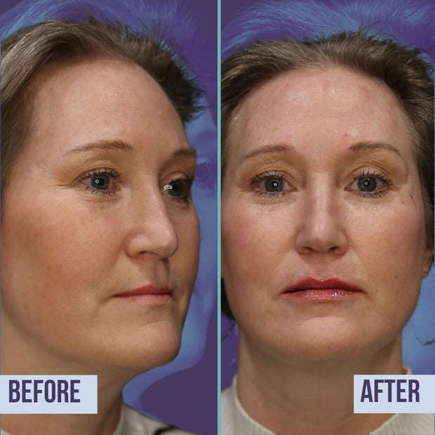 Images Mariposa Aesthetics & Laser Center