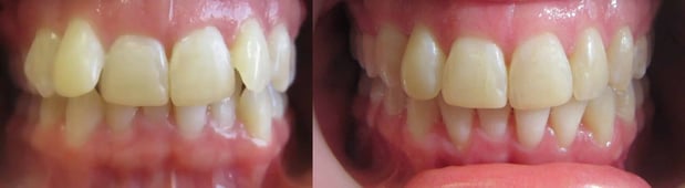 Images Premier Dental of South Orange County