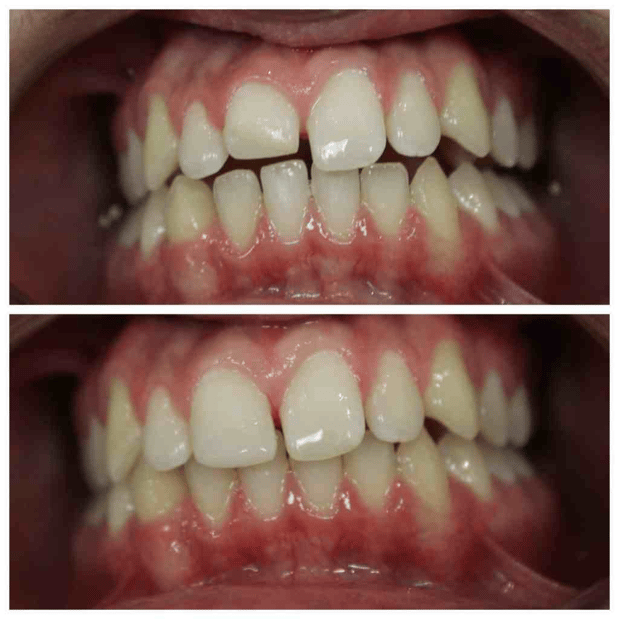 Images Summer Creek Dental