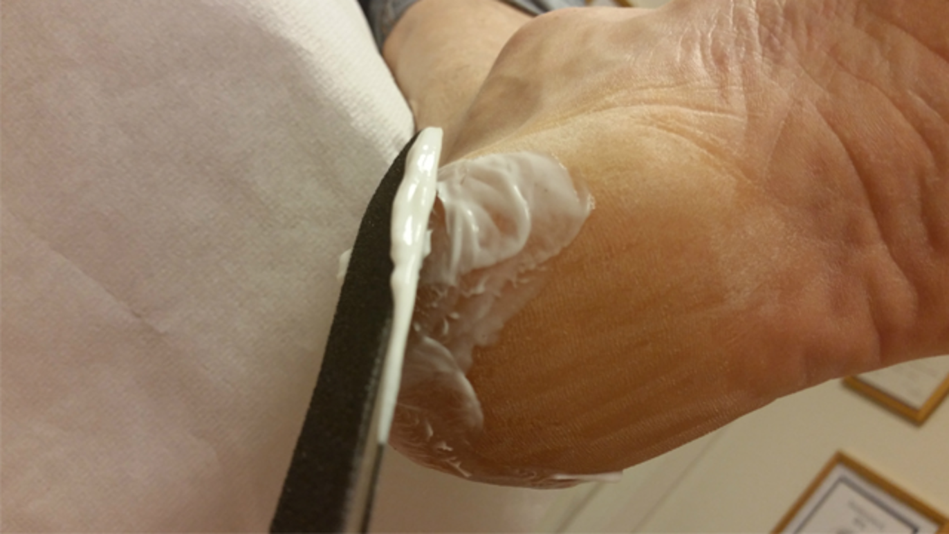 Images Kongsberg Fotterapi AS