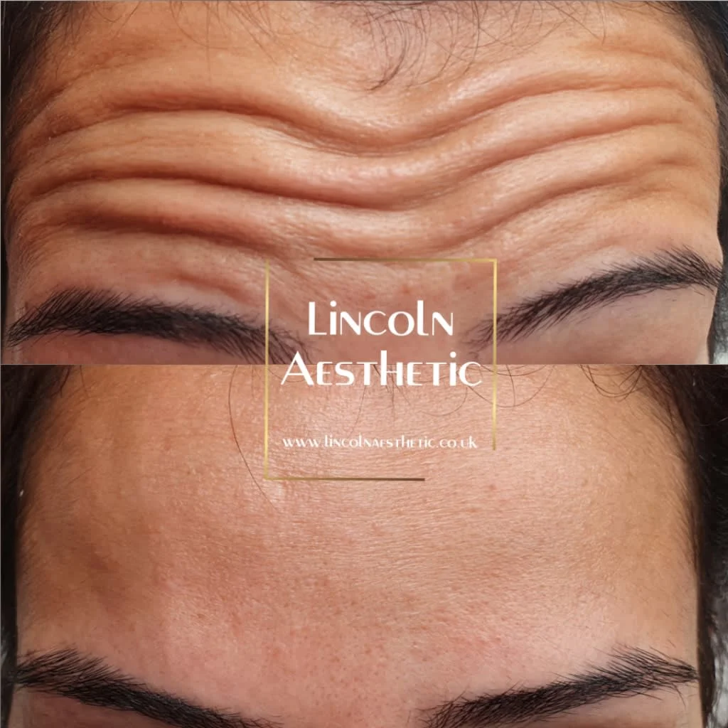 Images Lincoln Aesthetic