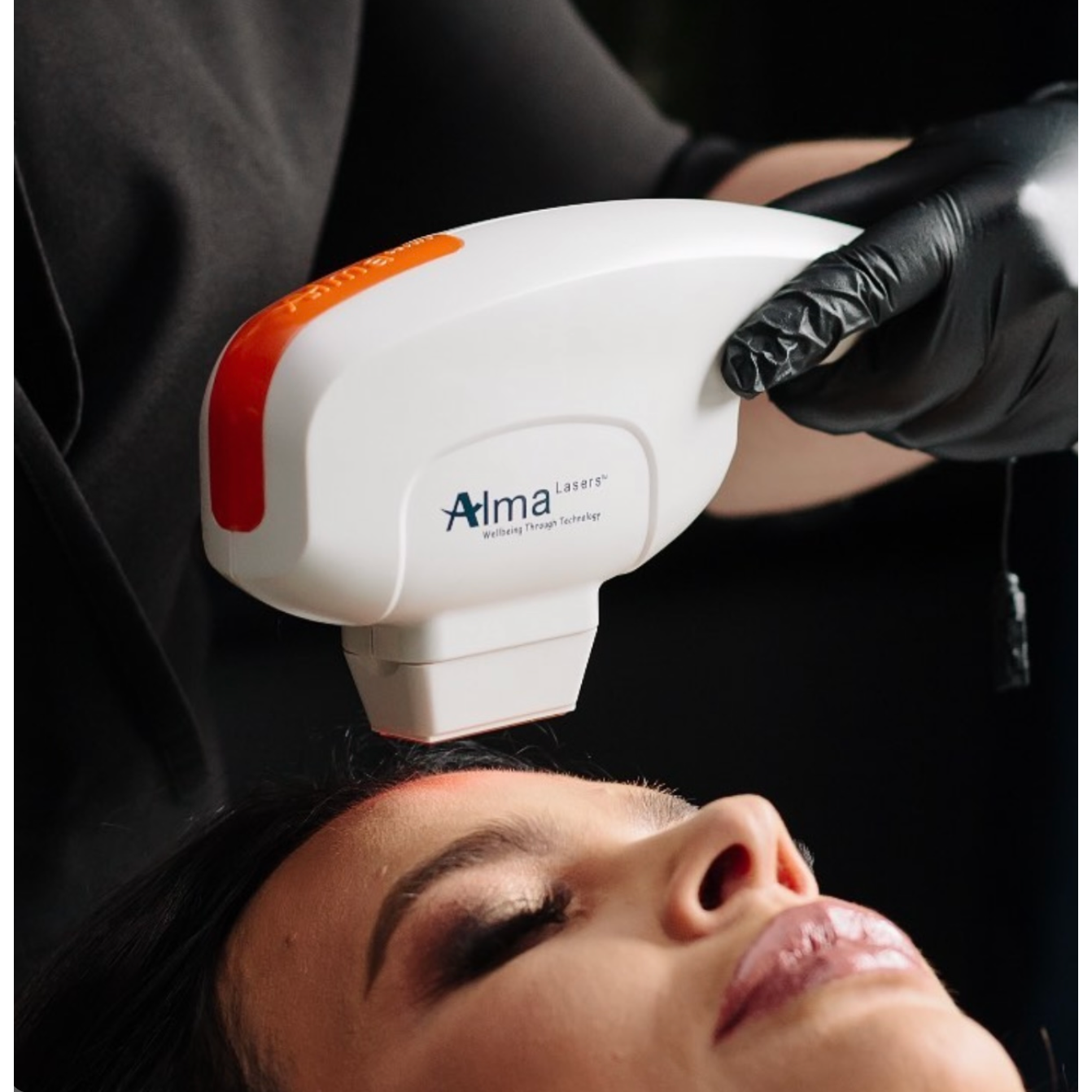 Alma laser treatment in Colorado Springs by Marysol Gill, designed for advanced skin rejuvenation, pigmentation improvement, sun spot treatment, uneven skin tone, and a smoother, brighter-looking complexion. A professional laser skin service for clients seeking customized skin renewal, facial rejuvenation, and visible skin improvement without surgery.