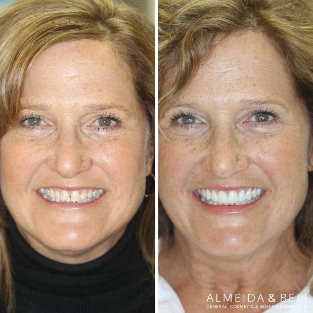 Images Almeida & Bell Dental Lone Tree - General, Cosmetic, and Implant Dentistry