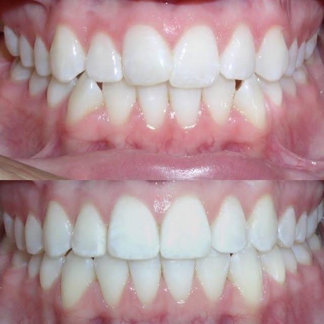 Images Smiles By Eddie: Dr. Edmond Ahdoot DDS