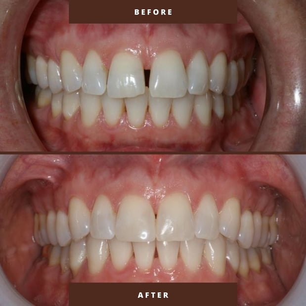 Images Victor R. Siegel, DDS