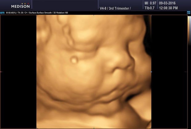 Images Heavenly 3D 4D Ultrasounds-Upland