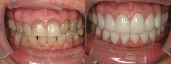 Images Handley Dental