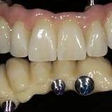 H&H - Zahnarztpraxis Verena & Klaus Heilig | München, Naupliastraße 105 in München