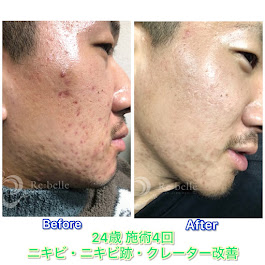 Images Blue beedro -メンズ美肌科学研究所-