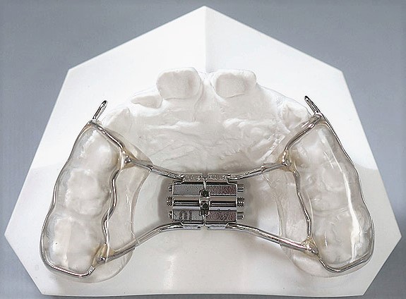 Hulme Orthodontics Photo