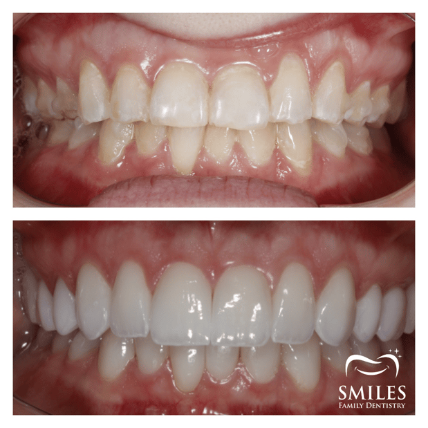 Images Brunswick Smiles Family Dentistry Implant, Oral Surgery, and Cosmetic Dentist