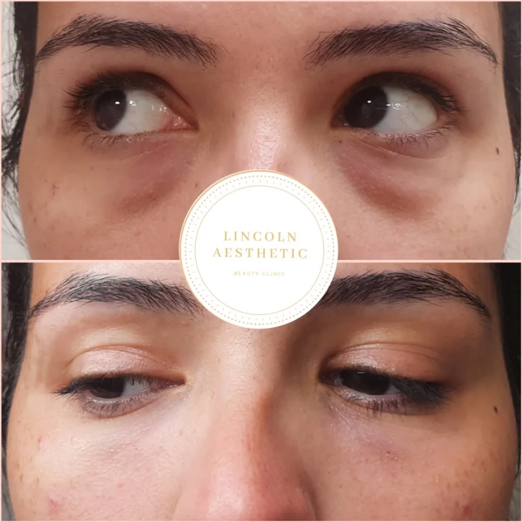 Images Lincoln Aesthetic