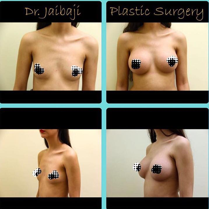 Jaibaji Plastic Surgery Photo