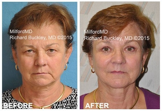 Images MilfordMD Cosmetic Dermatology Surgery & Laser Center