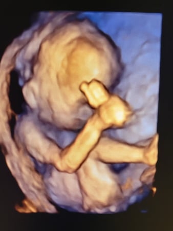 Images Love At First Sight 3D/4D Ultrasound Imaging Studio, LLC