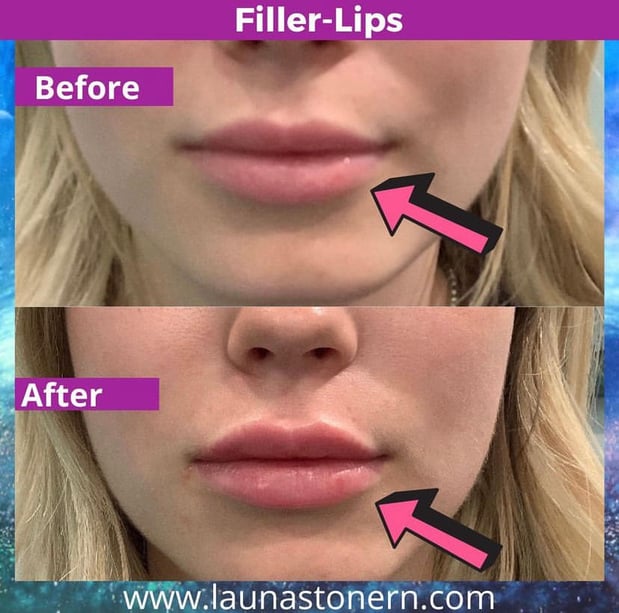 Images Launa Stone, R.N.