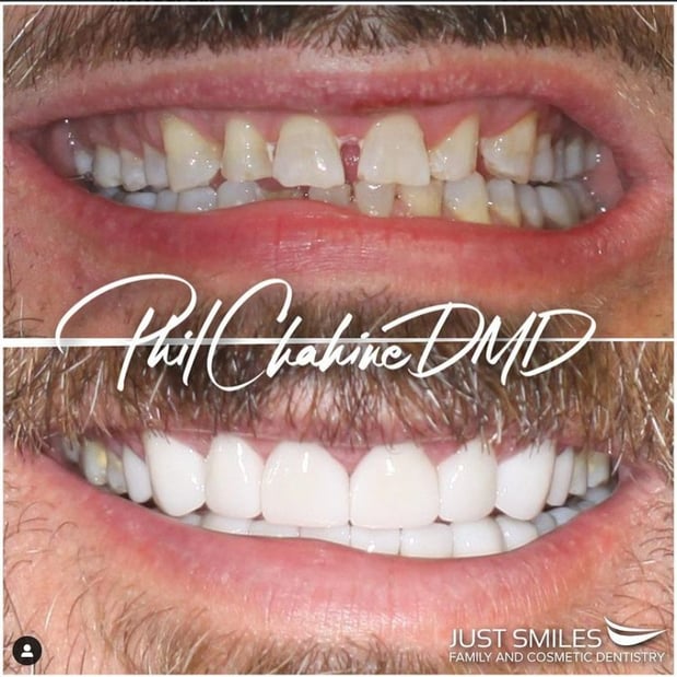 Images Just Smiles - General, Cosmetic & Implant Dentistry