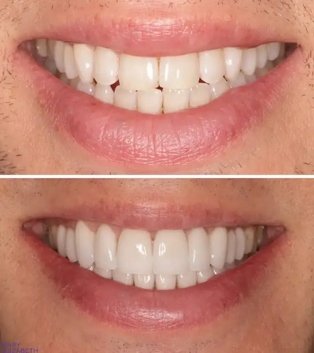 Images Mary Elizabeth Viechnicki, DMD